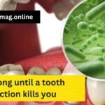 how long until a tooth infection kills you