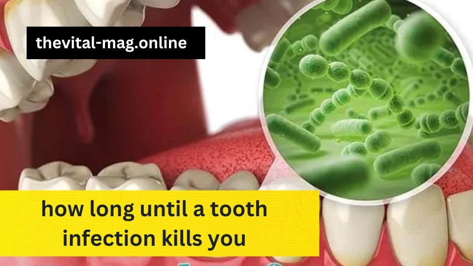 how long until a tooth infection kills you