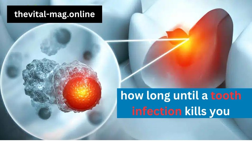 how long until a tooth infection kills you