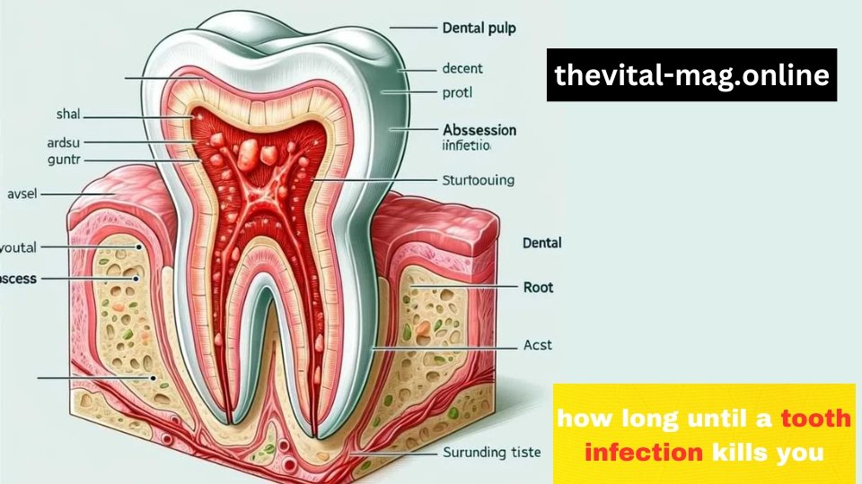 how long until a tooth infection kills you