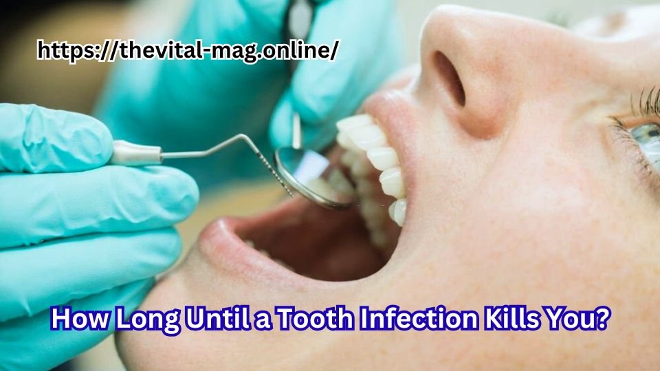 how long until a tooth infection kills you