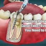 How Long Does a Root Canal Take