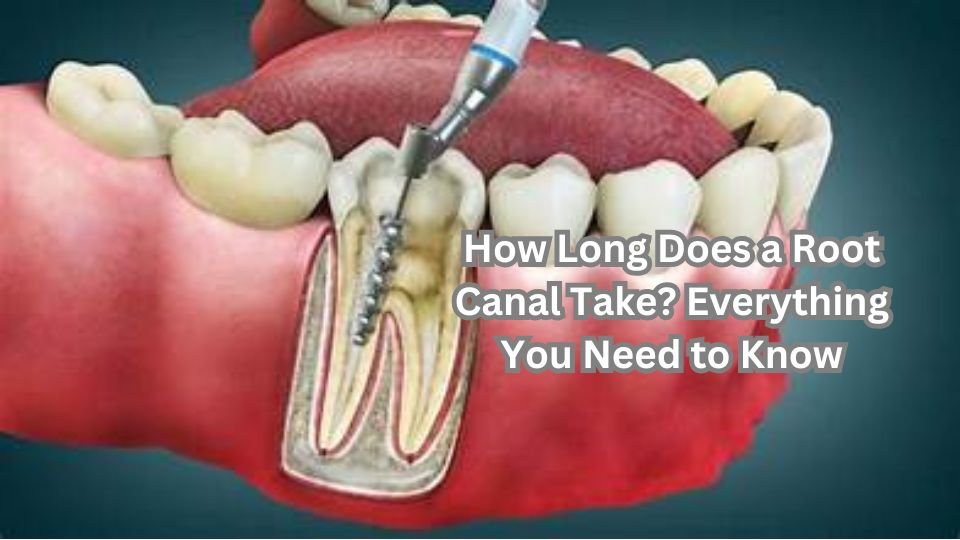 How Long Does a Root Canal Take